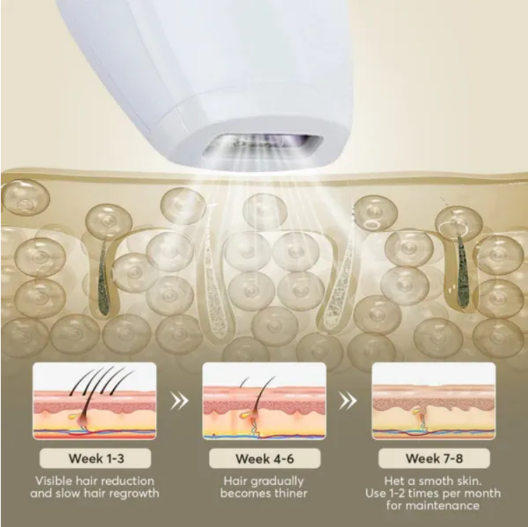 Professional IPL Laser Epilator — 900,000 Flashes, 5 Levels