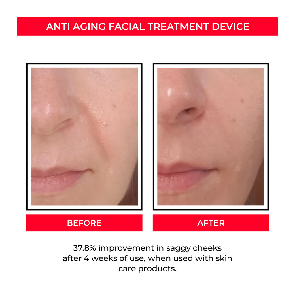 EMS Microcurrent Skin Rejuvenation Beauty Device — Pore & Firming System