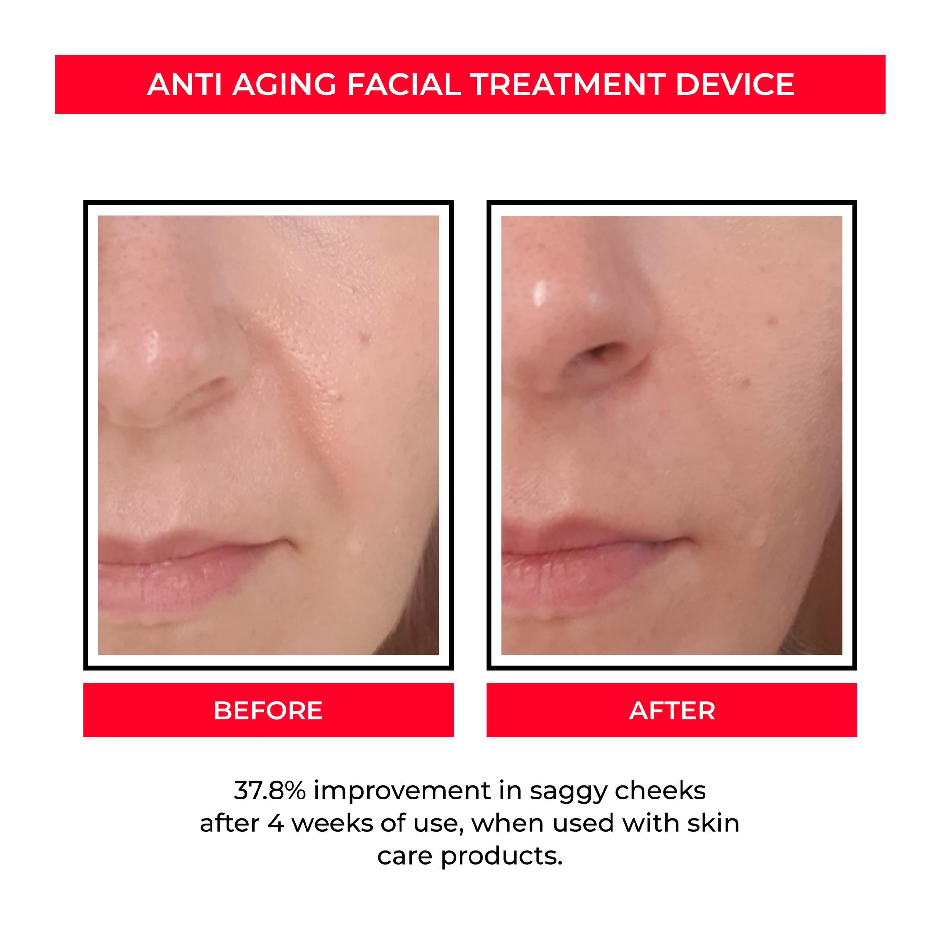 EMS Microcurrent Skin Rejuvenation Beauty Device — Pore & Firming System